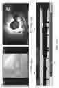 Fig. 16 - Systems and methods to detect and display endovascular features