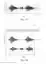 Fig. 06 - Device for acquiring and processing audible input