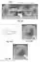 Fig. 26 - Wireless power control