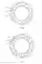 Fig. 08 - Stator assembly