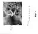 Fig. 08 - Method for assisted image improvement