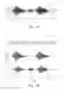 Fig. 06 - Direction detection device for acquiring and processing audible input