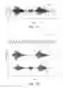 Fig. 06 - Direction detection device for acquiring and processing audible input