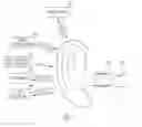 Fig. 05 - Hearing aid using wireless test modes as diagnostic tool