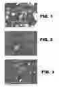 Fig. 02 - Seed flow lubricant compositions and uses thereof
