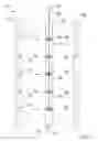 Fig. 05 - Retractable Deer Stand Ladder System