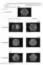 Fig. 07 - ENVIRONMENTAL IMPROVEMENT MATERIAL AND MANUFACTURING METHOD THEREOF