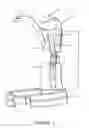 Fig. 02 - Shoulder transfer weight support