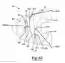 Fig. 49 - Dynamic lacing system