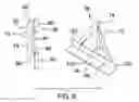 Fig. 06 - Canvas holding assembly
