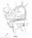 Fig. 02 - Baby carrier system