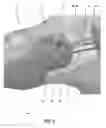 Fig. 05 - STEARABLE MICRO-ENDOSCOPE AND ZIP CATHETER