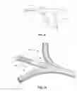 Fig. 08 - STEARABLE MICRO-ENDOSCOPE AND ZIP CATHETER