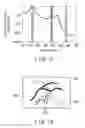 Fig. 13 - Endoscope apparatus for changing light quantity ratio between first emphasis narrow band light and first non-emphasis narrow band light and light quantity ratio between second emphasis narrow band light and second non-emphasis narrow band light