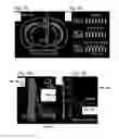 Fig. 06 - Method and systems for measuring neural activity