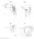 Fig. 02 - Optical speculum