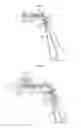 Fig. 04 - Optical speculum