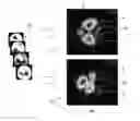 Fig. 01 - Method and apparatus for the non-invasive measurement of pulse transit times (PTT)