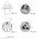 Fig. 02 - Method and apparatus for the non-invasive measurement of pulse transit times (PTT)