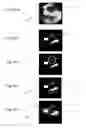 Fig. 06 - Method and apparatus for the non-invasive measurement of pulse transit times (PTT)