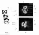 Fig. 07 - Method and apparatus for the non-invasive measurement of pulse transit times (PTT)