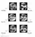 Fig. 09 - Method and apparatus for the non-invasive measurement of pulse transit times (PTT)