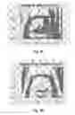 Fig. 06 - Image Processing System and Method