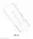 Fig. 04 - Vascular closure with shape memory characteristic
