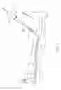 Fig. 02 - Systems and methods for treatment of perforator veins for venous insufficiency