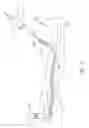 Fig. 03 - Systems and methods for treatment of perforator veins for venous insufficiency