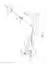 Fig. 09 - Systems and methods for treatment of perforator veins for venous insufficiency