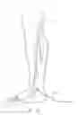Fig. 13 - Systems and methods for treatment of perforator veins for venous insufficiency