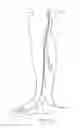 Fig. 19 - Systems and methods for treatment of perforator veins for venous insufficiency