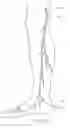 Fig. 22 - Systems and methods for treatment of perforator veins for venous insufficiency