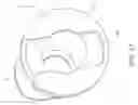Fig. 30 - Systems and methods for treatment of perforator veins for venous insufficiency