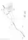 Fig. 54 - Systems and methods for treatment of perforator veins for venous insufficiency