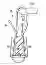 Fig. 01 - Knotless all suture tissue repair