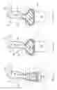 Fig. 05 - Knotless all suture tissue repair