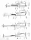 Fig. 04 - Delivering bioabsorbable fasteners