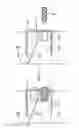 Fig. 01 - Method and implant for stabilizing separated bone portions relative to each other