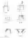 Fig. 02 - Method and implant for stabilizing separated bone portions relative to each other