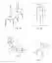 Fig. 03 - Method and implant for stabilizing separated bone portions relative to each other