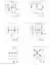 Fig. 06 - Method and implant for stabilizing separated bone portions relative to each other