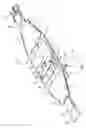 Fig. 02 - Abdominal aortic tourniquet