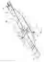 Fig. 07 - Abdominal aortic tourniquet