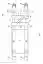 Fig. 10 - Abdominal aortic tourniquet