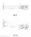 Fig. 06 - Implants, devices, systems, kits and methods of implanting