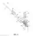 Fig. 07 - Implants, devices, systems, kits and methods of implanting