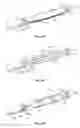 Fig. 04 - Methods for restoring blood flow within blocked vasculature