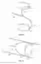 Fig. 15 - Methods for restoring blood flow within blocked vasculature